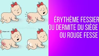 Érythème Fessier ou Dermite du siège ou Rouge fesse [upl. by Yorgerg]