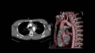 February 2015 Quiz [upl. by Salahcin789]