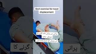 Navel displacement causes sign and symptoms and treatmentNaaf girnay ki wrzishyPhysical therapy [upl. by Bahr503]