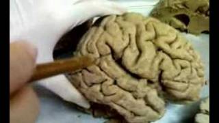 gyrussulcus of cerebrum [upl. by Janeen94]