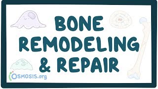 Bone remodeling and repair [upl. by Michi]