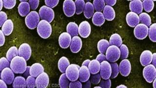 Staphylococcus aureus [upl. by Airpal]