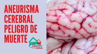 Aneurisma cerebral peligro de muerte [upl. by Abernathy255]