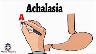 Achalasia [upl. by Einavoj]