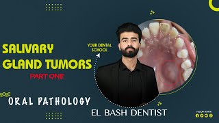 benign salivary gland tumors  oral pathology  عزت شومان [upl. by Champ]