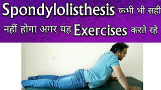 Spondylolisthesis Exercises  Exercises To AVOID For Spondylolisthesis TREATMENT [upl. by Ellett]