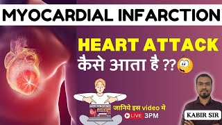 MYOCARDICAL INFARCTION HEART ATTACK कैसे आता है  IN HINDI GNM  GNM COURSE BY BHUSHAN SCIENCE [upl. by Drona128]