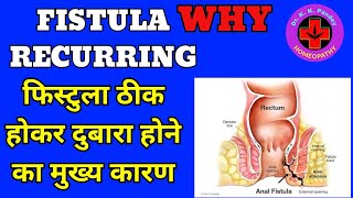 फिस्टुला दोबारा क्यों हो जाता है Fistula Recur After Homeopathy Treatment  Why Fistula Recurrence [upl. by Nolava]