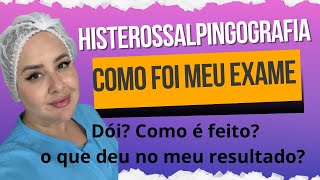 INFÉRTIL Histerossalpingografia como foi o meu exame e qual meu resultado [upl. by Hey]