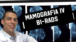 Mamografia IV BIRADS [upl. by Callas]