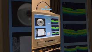 Optical Coherence Tomography  OCT 1080p [upl. by Oisinoid]