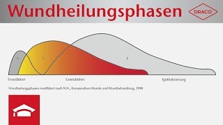 Wundheilungsphasen im Überblick  Exsudationsphase Granulationsphase Epithelisierungsphase [upl. by Sternick]