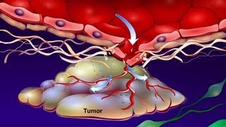 Introduction to Cancer Biology Part 4 Angiogenesis [upl. by Basham978]