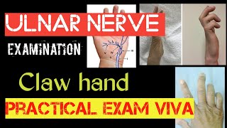 Examination of Ulnar nerve nerveorthopedicspractical exam clawhand [upl. by Almeeta]