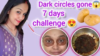 How to remove Dark circles at home🤔 darkcircles homeremedies diy [upl. by Clay]