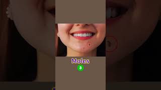 How to manage moles amp open pore Skin Care Tips  Dr Sarin [upl. by Wey]