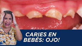 Caries en bebés ¡ojo [upl. by Lenno360]