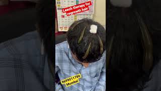 Leech Therapy for Hair Loss in Hindi leechtherapyleechhairhairhairfallhaircareshortsreelsdr [upl. by Alexei]