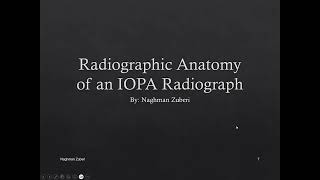 Intraoral Periapical X Ray Radiographic Anatomy [upl. by Ilahsiav380]