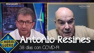 Antonio Resines habla sobre su larga lucha contra el Covid  El Hormiguero [upl. by Hairahcaz]