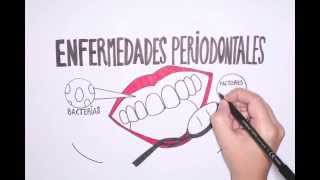 Periodontest Test Microbiológico y Genético de la Enfermedad Periodontal [upl. by Nosyerg]