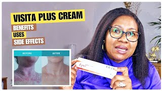 Vista Plus Cream amp Skin Bleaching How To UseBENEFITSSIDE EFECTS [upl. by Ylliw]