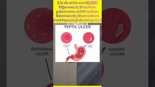 PANTOP 40। Pantoprazol।Uses in Hindi।Part2।pantoprazole pantop ulceraciditygasUlcer Gas Acidity [upl. by Ahseile114]