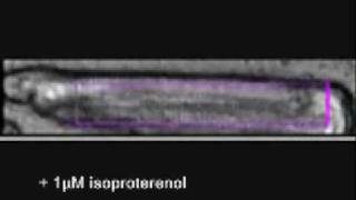 cardiac myocyte contractility [upl. by Arsuy]