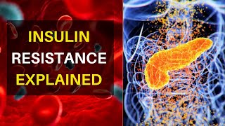 Insulin Resistance Explained  Why And How It Happens  Key Signs And Symptoms To Look Out For [upl. by Noxid285]