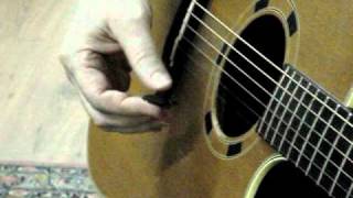 6Guitarist and hand dystonia difficulty holding the plectrum [upl. by Ahseet]