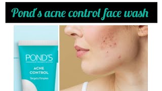 ponds acne control face wash best face wash for acne amp Oily skin ponds face wash reviews review [upl. by Clayson]