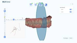 Intraoral Scanner Measurement Tool Using Guides [upl. by Kristoforo]