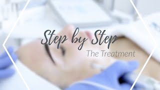 Dermatude Step by Step EN  The Treatment [upl. by Ainesy]