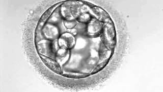 Development of hatching Embryo blastocyst stage [upl. by Ilecara830]