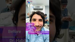 Rhinoplasty Transformation Reveal 🌟✨ Stunning Nose Job by Dr Habib 👃  Peshawar Pakistan 📍 [upl. by Florence952]