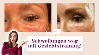 Geschwollene Augen wegbekommen Erfahrungsbericht [upl. by Sedda]