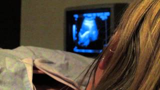 IVF diary  9  IVF the secret cycle  Embryo Transfer IVF [upl. by Mayer]