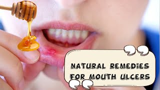 How To Relieve Mouth Ulcers Naturally And Effectively Natural Remedies For Mouth UlcersCanker Sore [upl. by Riordan554]