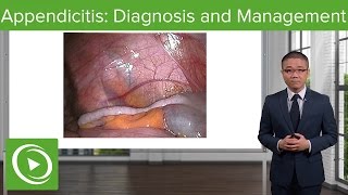 Appendicitis Diagnosis and Management – General Surgery  Lecturio [upl. by Halilad641]