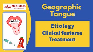 Geographic tongue Benign Migratory Glossitis [upl. by Fleeman]