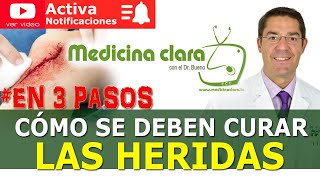 CURAR HERIDAS 🩸 3 PASOS SENCILLOS 👨‍⚕️ ¿Dejar herida tapada o al aire  Medicina Clara [upl. by Keiko]