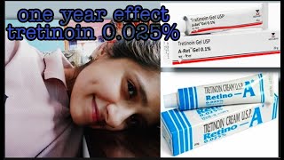 Tretinoin cream 0025 effects after one year [upl. by Lasorella881]