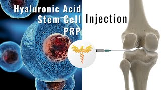 PRP Stem cells or hyaluronic acid injection to delay knee replacement surgery  A new study [upl. by Hadeehuat489]