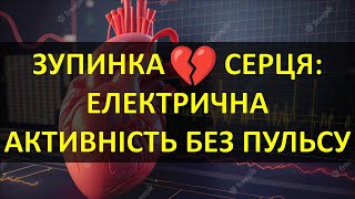 ЗУПИНКА КРОВООБІГУ ЕЛЕКТРИЧНА АКТИВНІСТЬ БЕЗ ПУЛЬСУ ОСОБЛИВОСТІ РЕАНІМАЦІЙНИХ ЗАХОДІВ [upl. by Leahcar]