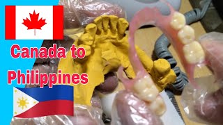 Flexible Dentures From Canada to Philippines [upl. by Anallese]