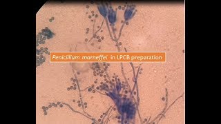 Penicillium marneffei [upl. by Ahseim]