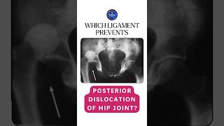 Which ligament prevents the posterior dislocation of hip joint shorts hipjoint ligaments [upl. by Whitehurst107]