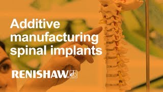 Streamlining additive manufacturing for spinal implants [upl. by Eduj866]