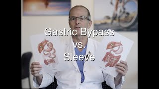 Gastric Bypass vs Sleeve update for 2021 [upl. by Zacharias392]