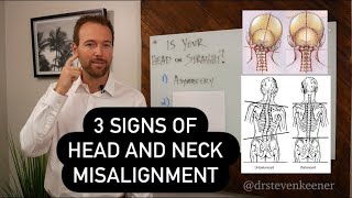 3 Signs of Head and Neck Misalignment  Dr K’s Sunday Special [upl. by Gower]